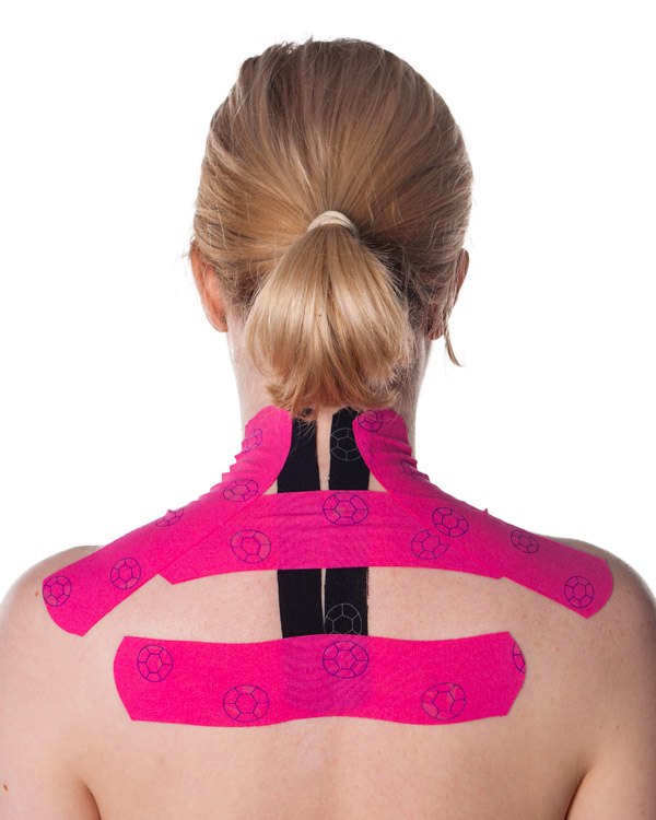 Kinesio Taping for Neck Pain (Basic)